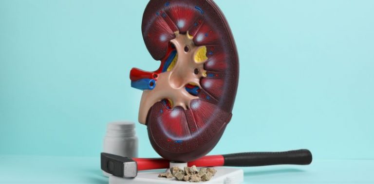 treatments for kidney disease